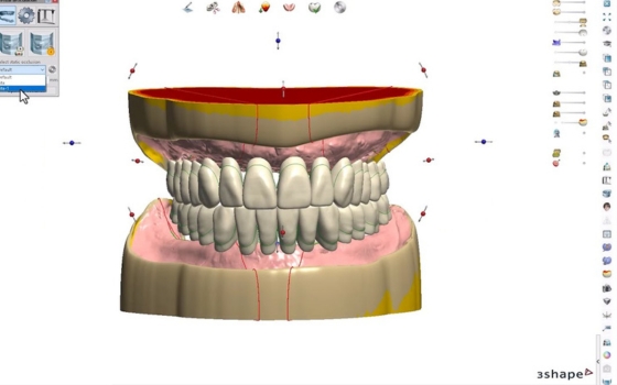 digitalna stomatologija novi sad dental hub
